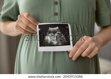 Prenatal ultrasound screening. Cropped close up shot of young pregnant female holding sonogram picture of unborn baby inside her big belly. Happy expectant mom showing fetus usi scan image to camera Stockfoto © 