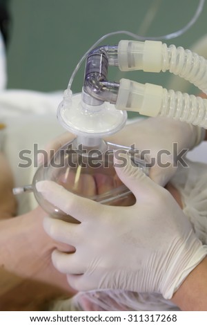 anesthesiologist\'s hands put the mask on a patient\'s face making an anesthesia