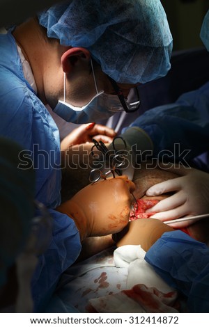 man surgeon in surgical uniform with tools in his hands makes an operation