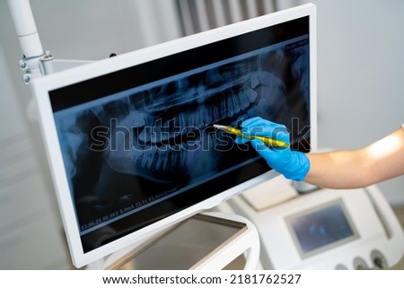 Modern digital radiology for stomatology. Teeth dentistry x ray examination. Stockfoto © 