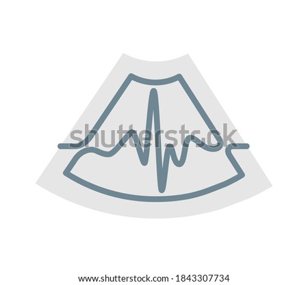 Electrocardiogram graph on the background of the ultrasound screen