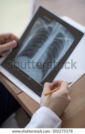 Closeup of doctor hands  holding chest and lungs xray in medical office