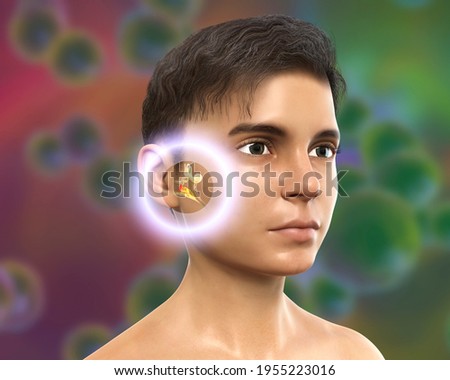 Otitis media, a group of inflammatory diseases of the middle ear, 3D illustration showing a boy with highlighted structures of middle and inner air and accumulation of pus in the middle air Stock fotó © 