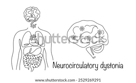 A disorder in which nervous system control over the functions of internal organs is impaired. Hand drawn problem in the work between the brain and internal organs. Vector line illustration.