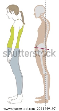 Sideways woman and skeleton standing in stooped, sway-back posture