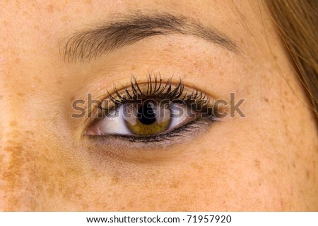 Close up of woman eye and surrounding skin showing sun damage, commonly known as freckles.