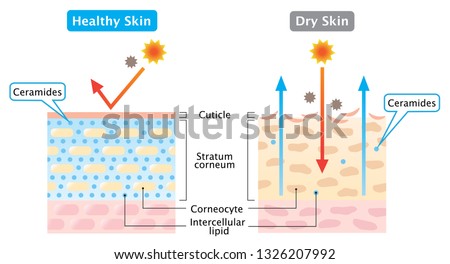 dry and healthy skin layer illustration. beauty and skin care concept