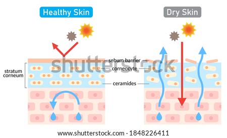 dry and healthy skin layer illustration. beauty treatment and skin care concept
 Сток-фото © 