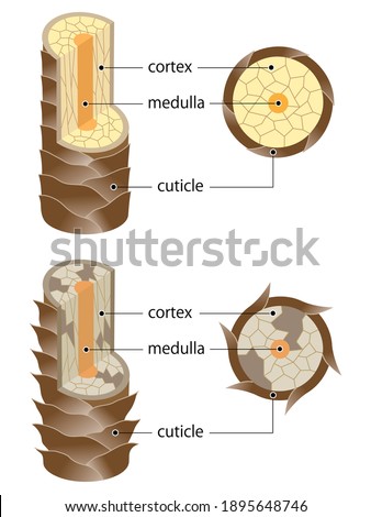 layer of healthy and damaged hair structure. The hair shaft consists of cortex,cuticle, and medulla.hair care and beauty concept
