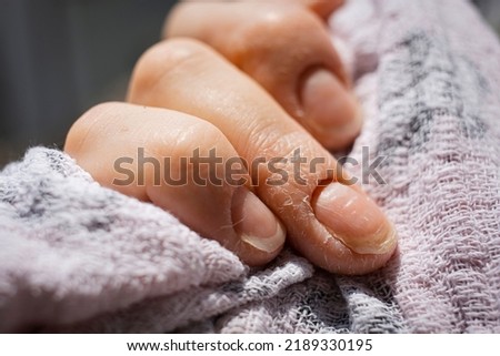 Close-up of a young mother's hand with Beau lines on ring finger Photo stock © 