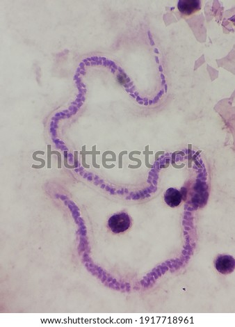 Parasitology slide of Wuchereria bancrofti adult Zdjęcia stock © 