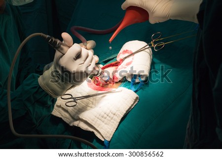 neurology  surgery