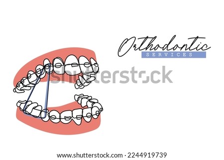 Continuous line art of Orthodontic treatment. Dentists day and respect for their services to humanity. Dental procedures vector art concept. Isolated vector of teeth and jaws. Retainers braces denture