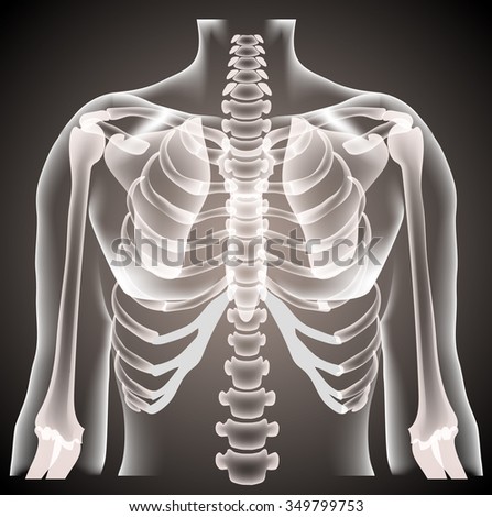  surgeon radiologist medical examaning lung torso  x-ray, vector