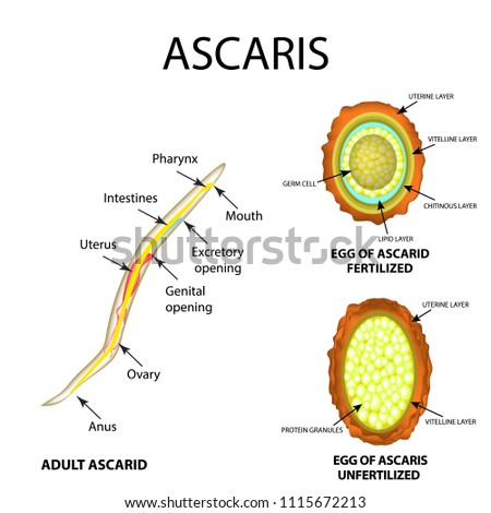 Ascaris helminthiasis. Felnőttkori aszcariasis tünetek áttekintése