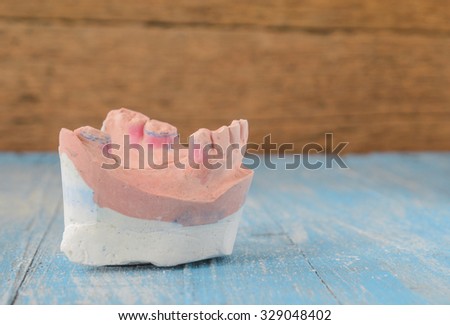 Denture mold,broken tooth placed on wooden floor.