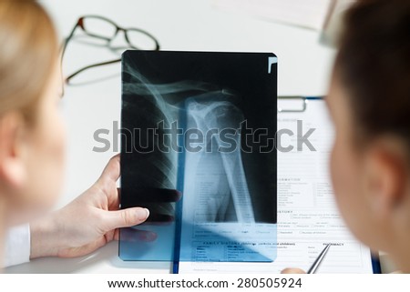 Two female doctors examining x-ray photography of patient to detect problem. Professional conversation, council of physicians. Working conference. Radiologist or traumatologist medical concept