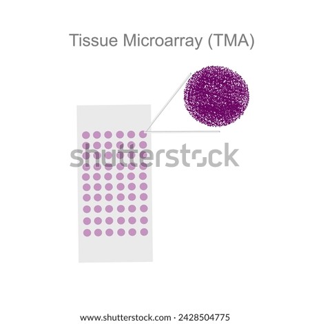 The Tissue Microarray (TMA) slide contains the various small samples that can focus and amplify for target detection.