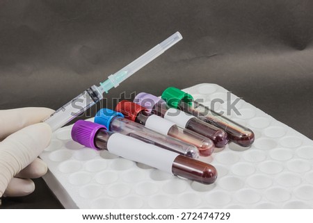 Syringe, needle and specimen on tube blood collection for test in laboratory.