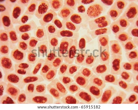 Original photo of healthy dividing red cells (meristem tissue)