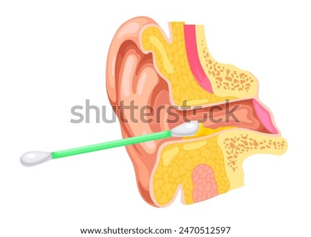 Ear canal cleaning. Ears clean earwax inside with cotton swab, otorhinolaryngology concept earing canal closeup anatomy dirty wax cerumen problem, ingenious vector illustration of earwax ear