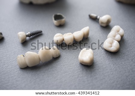 dentures and crowns
