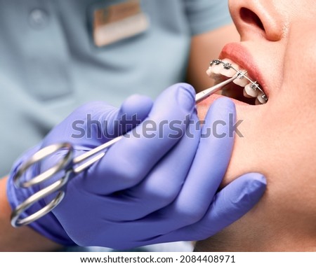 Close up of dentist hand putting elastic rubber band on patient brackets. Woman with wired metal braces on teeth receiving orthodontic treatment. Concept of stomatology, dentistry and orthodontics. Сток-фото © 