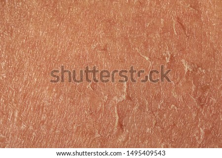 An extreme closeup view on the flaky skin of an aging caucasian person. Shedding and peeling skin fills the frame creating textured background with room for copy. Foto d'archivio © 