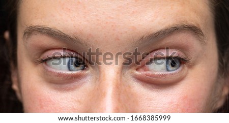 Similar – Image, Stock Photo sidelong glance