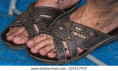 dirty males Fly infested feet in Leather Sandals