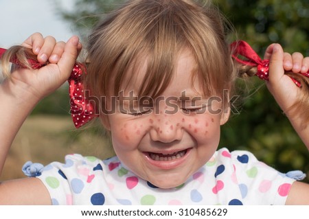 A funny cute outdoor close up portrait of a little girl presenting Pippi Longstocking with her eyes closed and making faces
