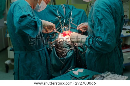 A team of neurosurgeons performing brain surgery to remove a tumor in the University hospital \