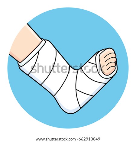 Orthopedic plaster or fiberglass cast, broken leg, bone fracture, vector icon.