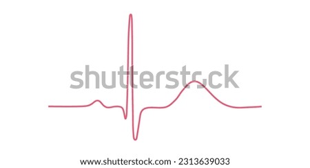 Ventricular repolarization, T wave. The QT interval of ECG. The cardiac cycle. ECG of a heart in normal sinus rhythm. Resources for teachers and students.