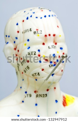 acupuncture demonstration on a model