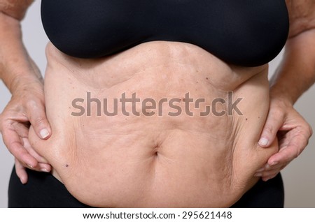 Close up Front View of a Middle Aged Woman in Black Underwear Holding the Sides of her Fatty Belly Against Light Blue Background.