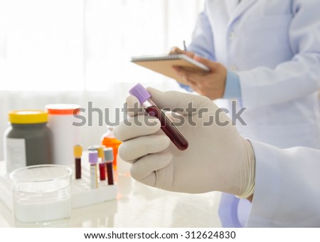 Doctor holding a bottle of blood sample in lab. science and medical concept