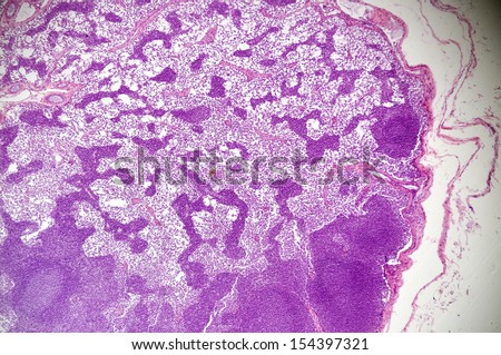 Microscopic view of lymph node