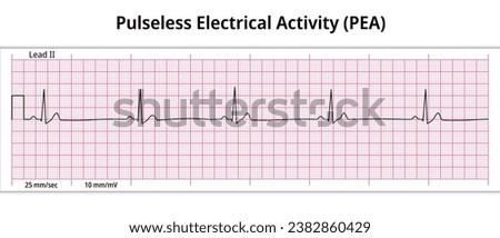 ECG Pulseless Electrical Activity (PEA) -  8 Second ECG Paper - Electrocardiogram Vector Medical Illustration