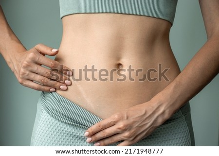 A woman shows a scar from appendicitis on her stomach Imagine de stoc © 