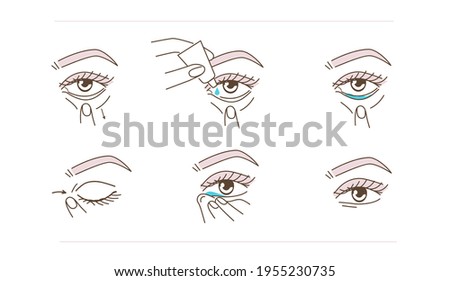 Woman Using Eye Drops Bottle. Instruction how to Correctly  Applying Eyedrops. Ophthalmology Healthcare against Redness, Allergy, Dry Eyes. Flat Line Vector Illustration and Icons set.