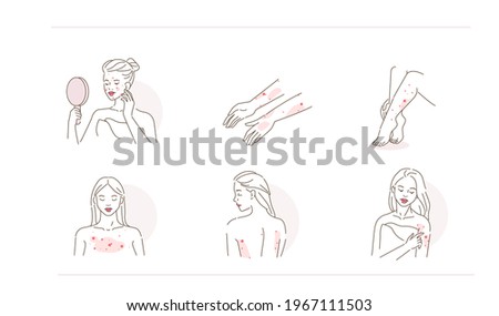 Beauty Girl Have Allergy and Acne Skin Problems. Woman Scratching her Body and Face with Hand. Allergic Dermatitis, Eczema or Nettle Rash with Itch Symptoms. Flat Line Cartoon Vector Illustration. Zdjęcia stock © 