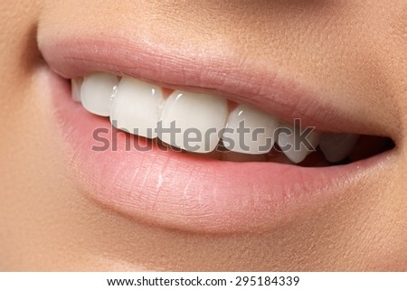 Close-up of smile with white healthy teeth