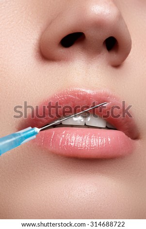 Closeup of beautiful woman gets injection in her lips. Full\
lips. Beautiful face and the syringe (plastic surgery and cosmetic injection\
concept).