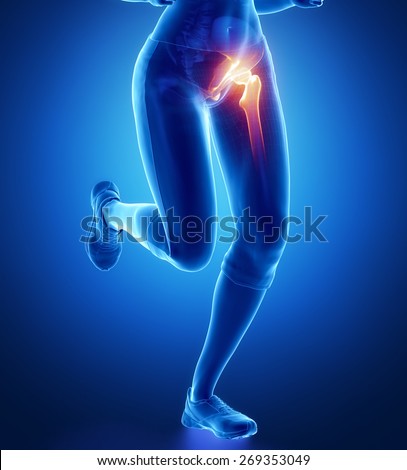 Pain in hip