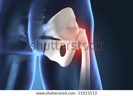 Human Hip Problem Stock Photo 51013513 : Shutterstock