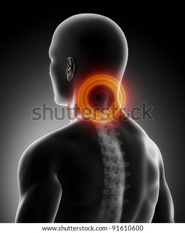 Pain in cervical spine anatomy
