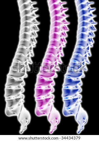 model of spinal column isolated on black background