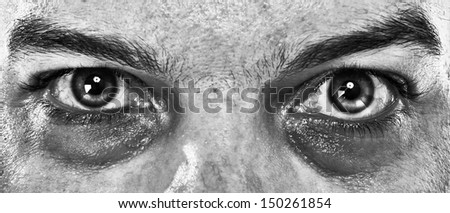 close up of a man's Sick eyes about to die. In Black and White.