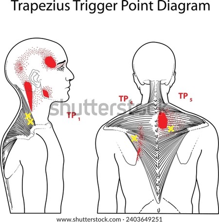 Trapezius Trigger Point Diagram Vector